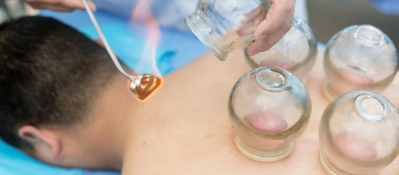 Όσα πρέπει να γνωρίζετε για τις βεντούζες με ποτήρια - Τι μας προσφέρουν;